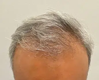 HAIR SPECIALIST